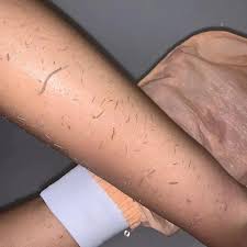 ESTYLO™-Skin exfoliating gloves ESTYLO™