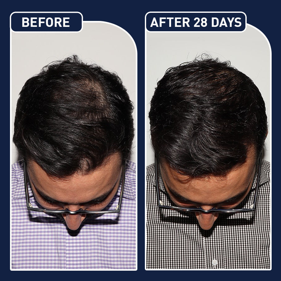 Tijarah™-FEG Plus Hair Growth Spray