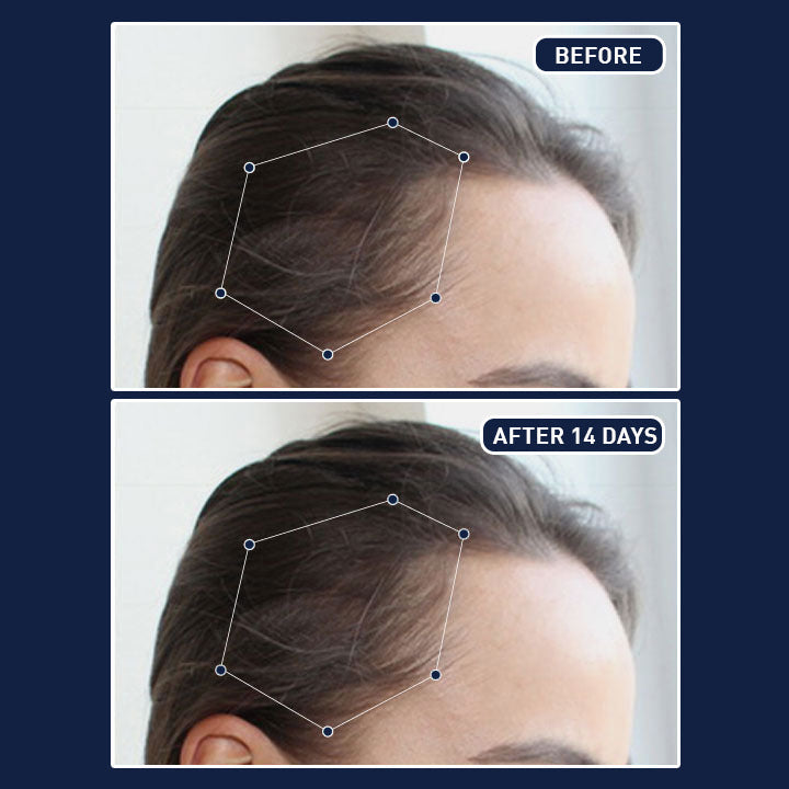 Tijarah™-FEG Plus Hair Growth Spray